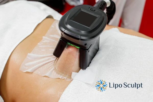 Does Fat Freezing at Home Work? DIY Devices vs Professional Cryolipolysis 1 How is professional cryolipolysis different Lyndhurst?